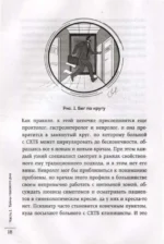Тазовая боль. Почему она возникает и что с ней делать — изображение 2