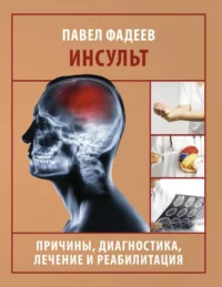 Инсульт. Причины, диагностика, лечение и реабилитация. Павел Фадеев