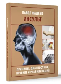 Инсульт. Причины, диагностика, лечение и реабилитация — Здоровье и его профилактика